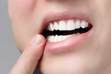 Tooth_Sensitivity