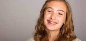 choosing-an-orthodontist