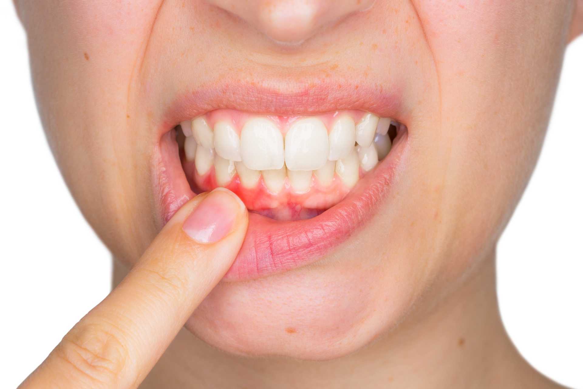 Keep Your Gums Healthy Keep Your Gums Healthy