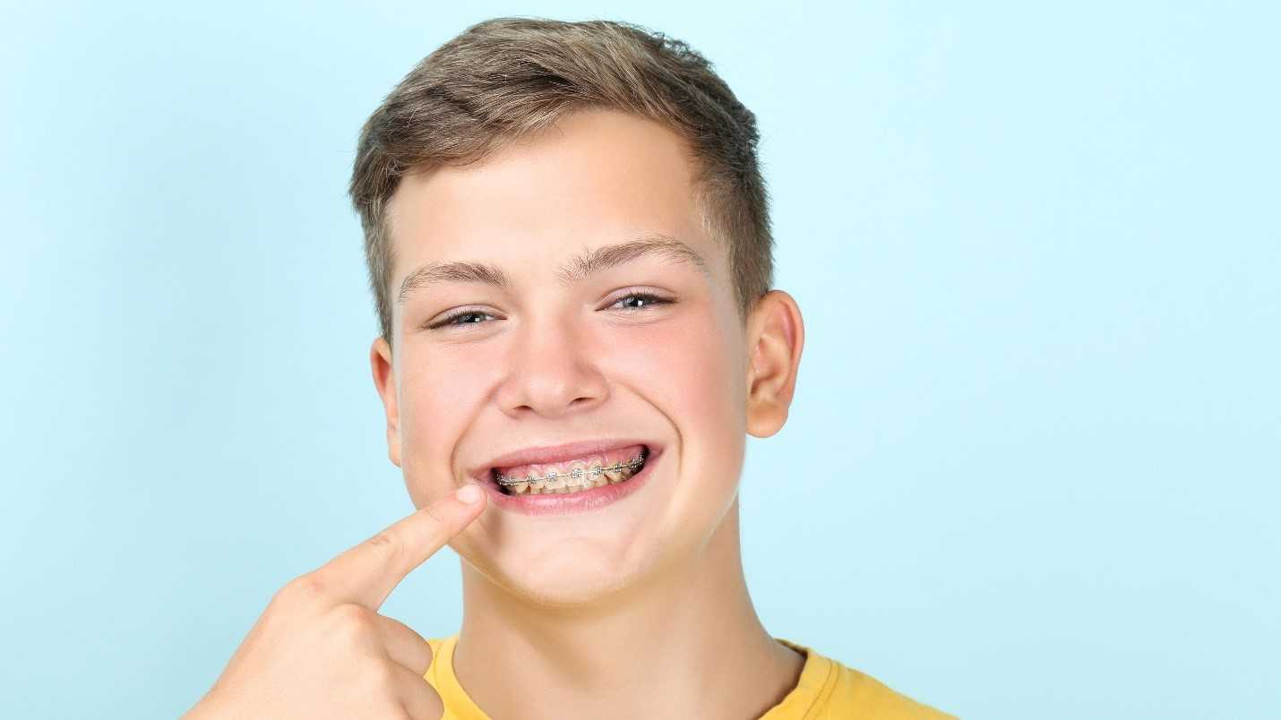 When To Start Orthodontic Treatment When To Start Orthodontic Treatment