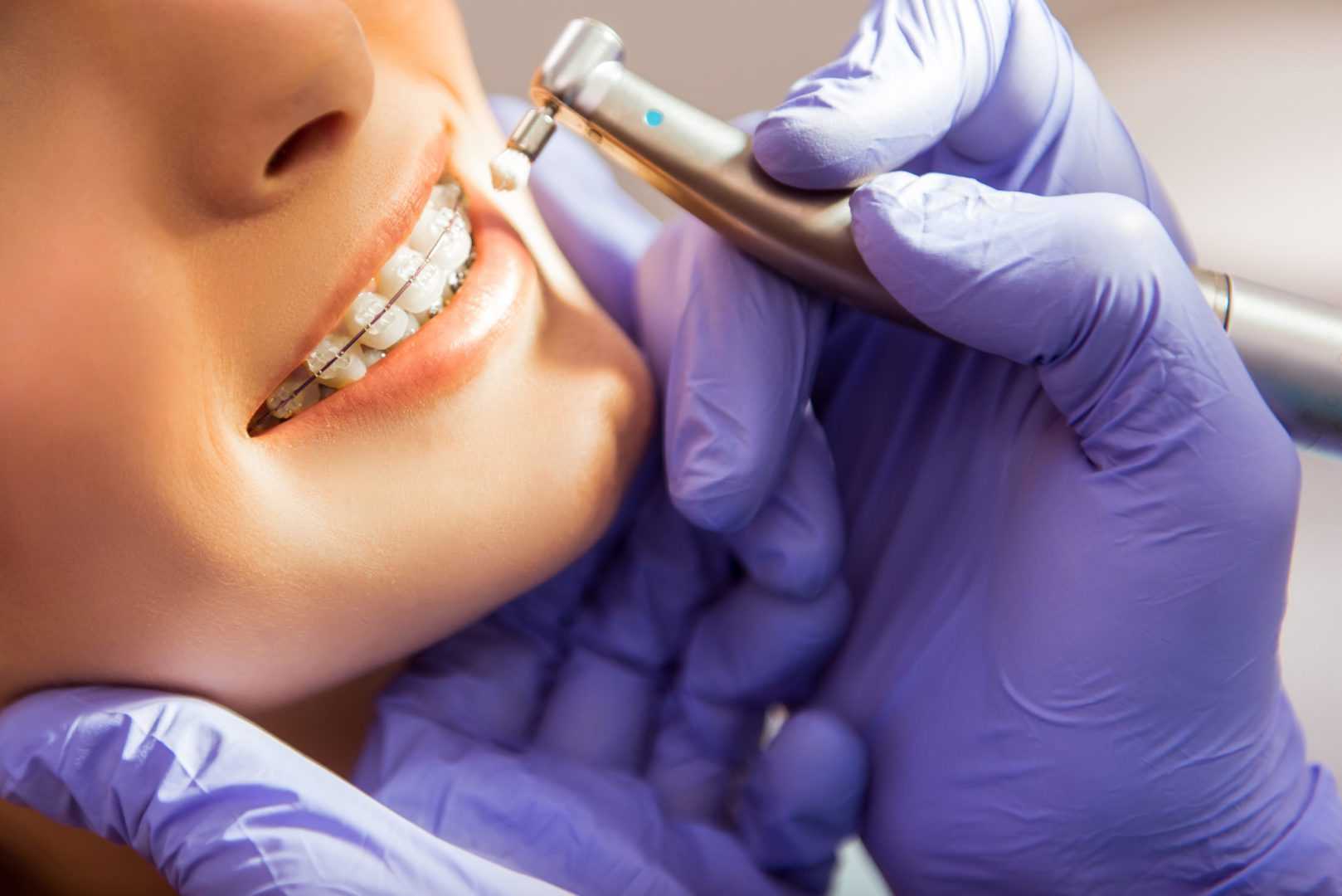 Dental-Cleaning