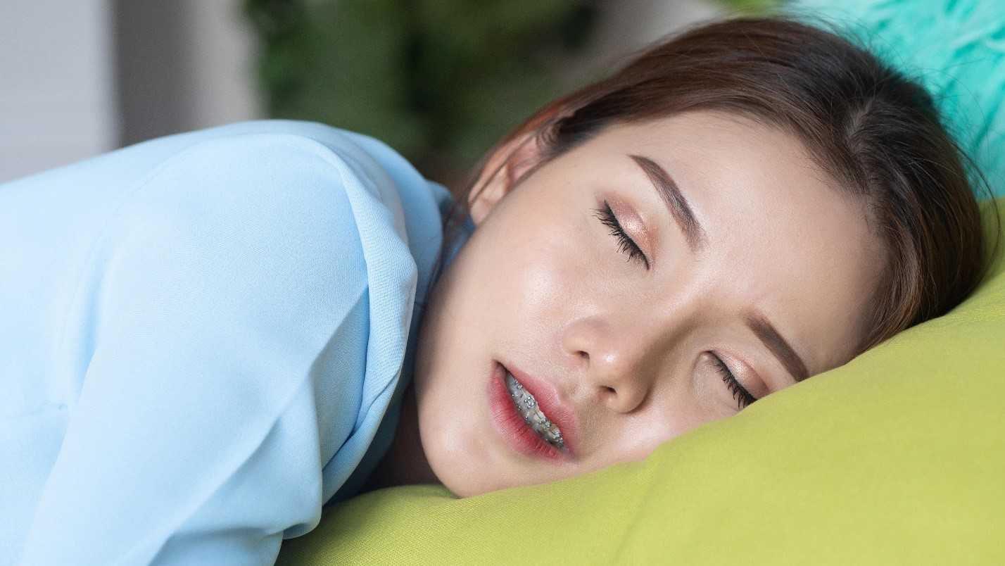 Can You Sleep with Orthodontic Wax? Woman Sleeps While Wearing Orthodontic Wax On Braces