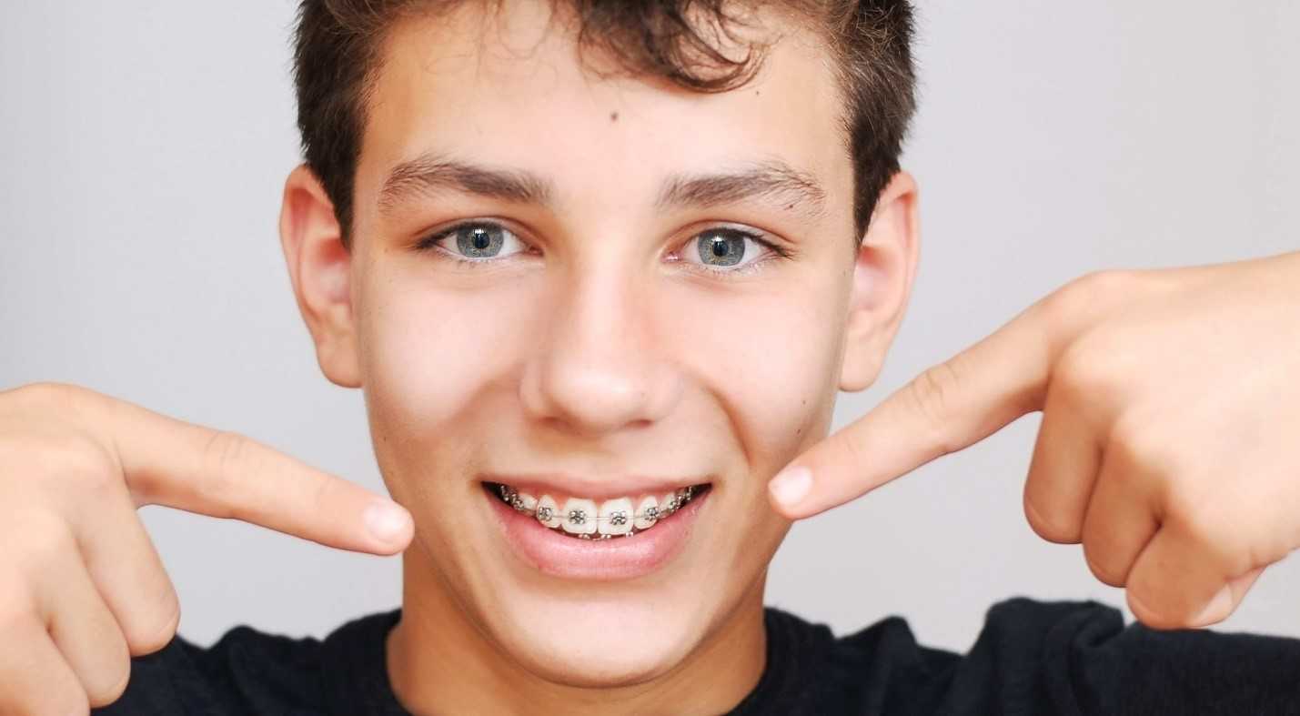 How Long Do Braces Take Boy points to braces and wonders, “how long do braces take?”